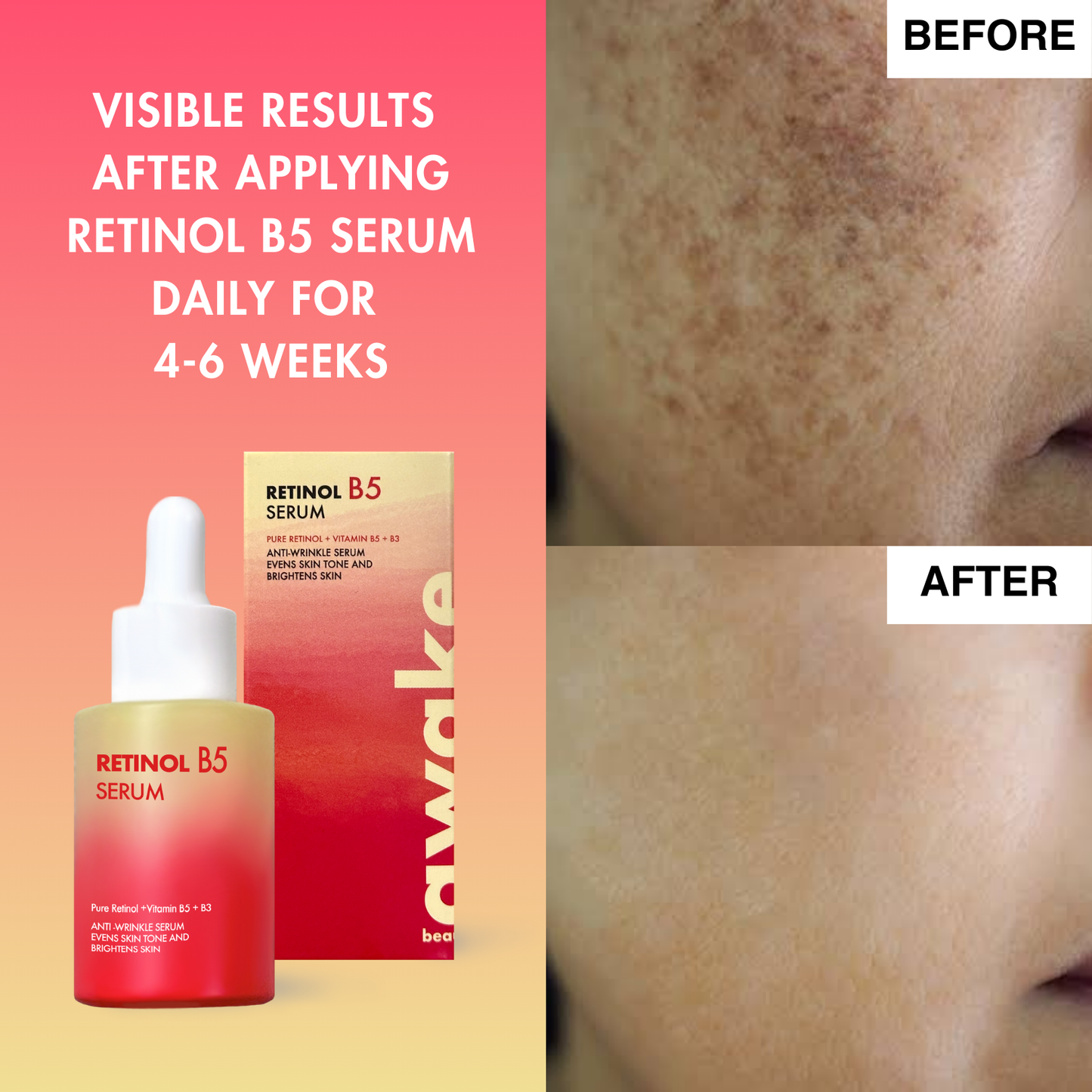 Retinol B5 Serum