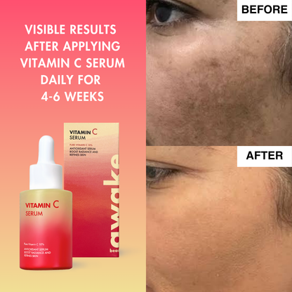 Vitamin C Serum