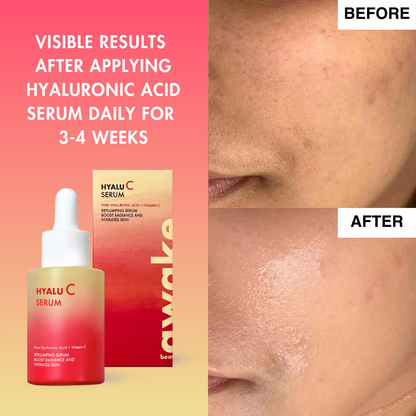 Hyalu C Serum