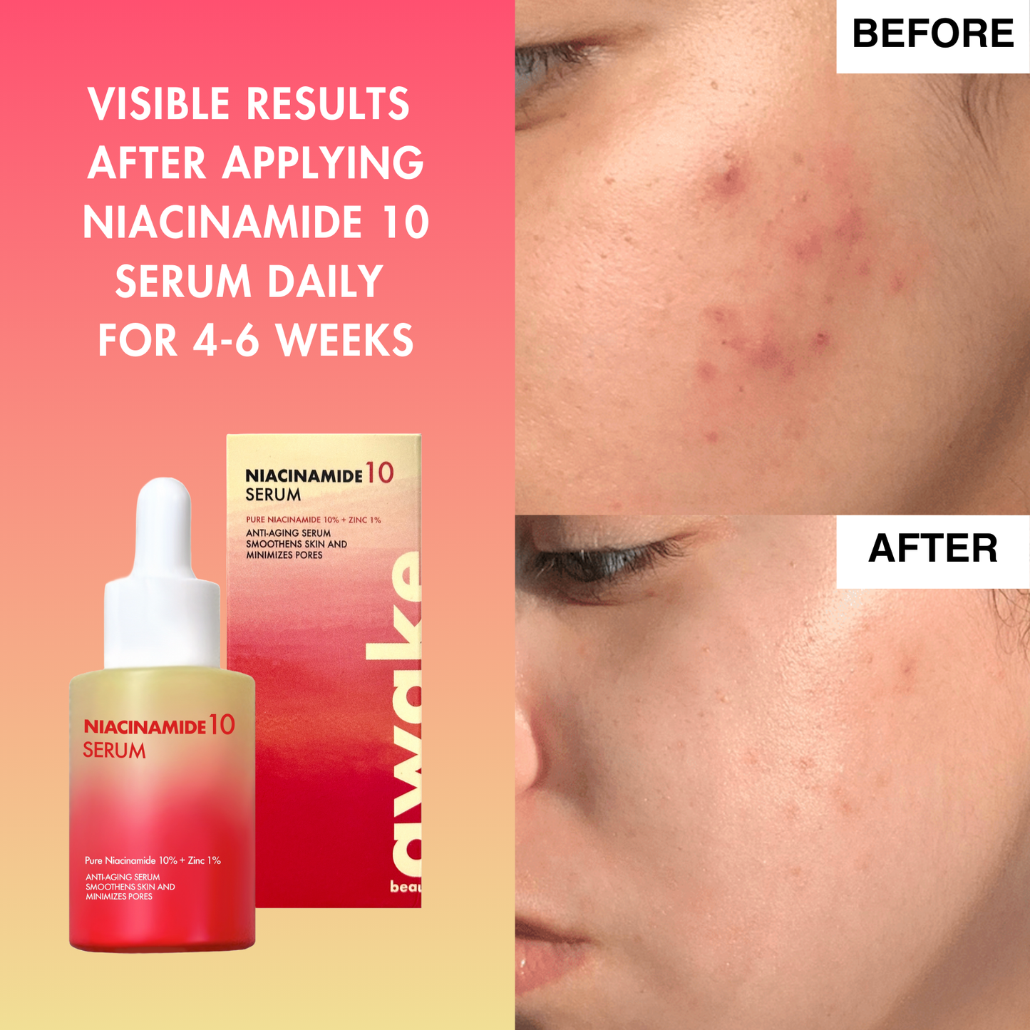 Niacinamide 10 Serum